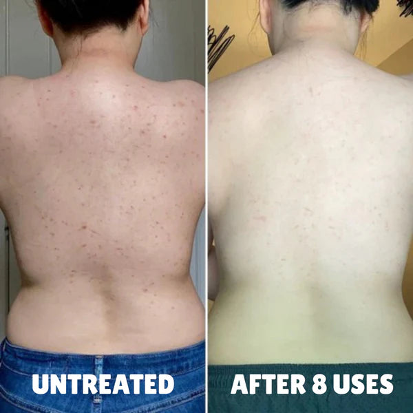 Ma dermatologue a vu la différence
